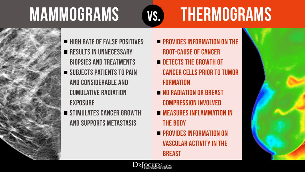 Μαστογραφία (mammogram). Είναι απαραίτητη ή εμπεριέχει κινδύνους και έχει πενιχρά αποτελέσματα; *